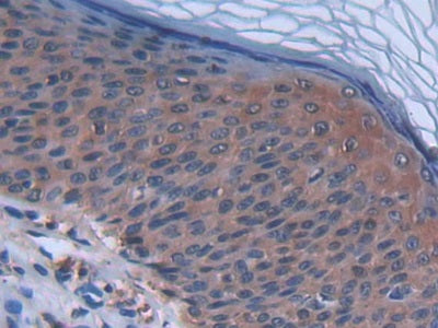 DAB staining on fromalin fixed paraffin-embedded Ovary tissue)