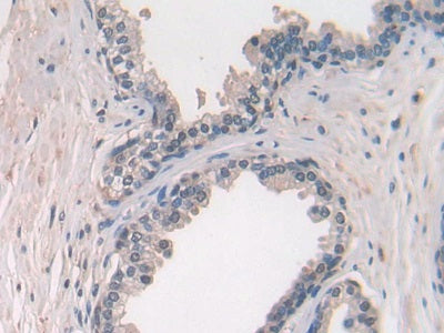 Chemokine (C-X-C Motif) Ligand 27 (CCL27) Polyclonal Antibody - image 4