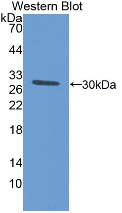 Interleukin 17 Receptor A (IL17RA) Polyclonal Antibody - image 2