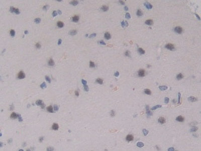 DAB staining on IHC-P; Samples: Rat Brain Tissue