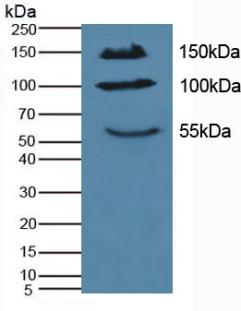 Western Blot; Sample: Recombinant IL17RA, Mouse.