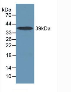 DAB staining on IHC-P; Samples: Mouse Lung Tissue; Primary Ab: 10µg/ml Rabbit Anti-Mouse IL17RA Antibody Second Ab: 2µg/mL HRP-Linked Caprine Anti-Rabbit IgG Polyclonal Antibody