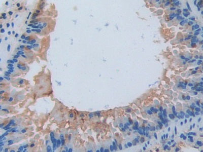 DAB staining on IHC-P; Samples: Mouse Kidney Tissue.