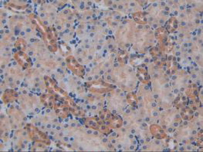 Interleukin 17 Receptor A (IL17RA) Polyclonal Antibody - image 5