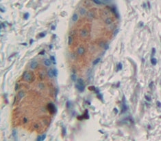 Prostaglandin D2 Synthase (PTGDS) Polyclonal Antibody - image 3