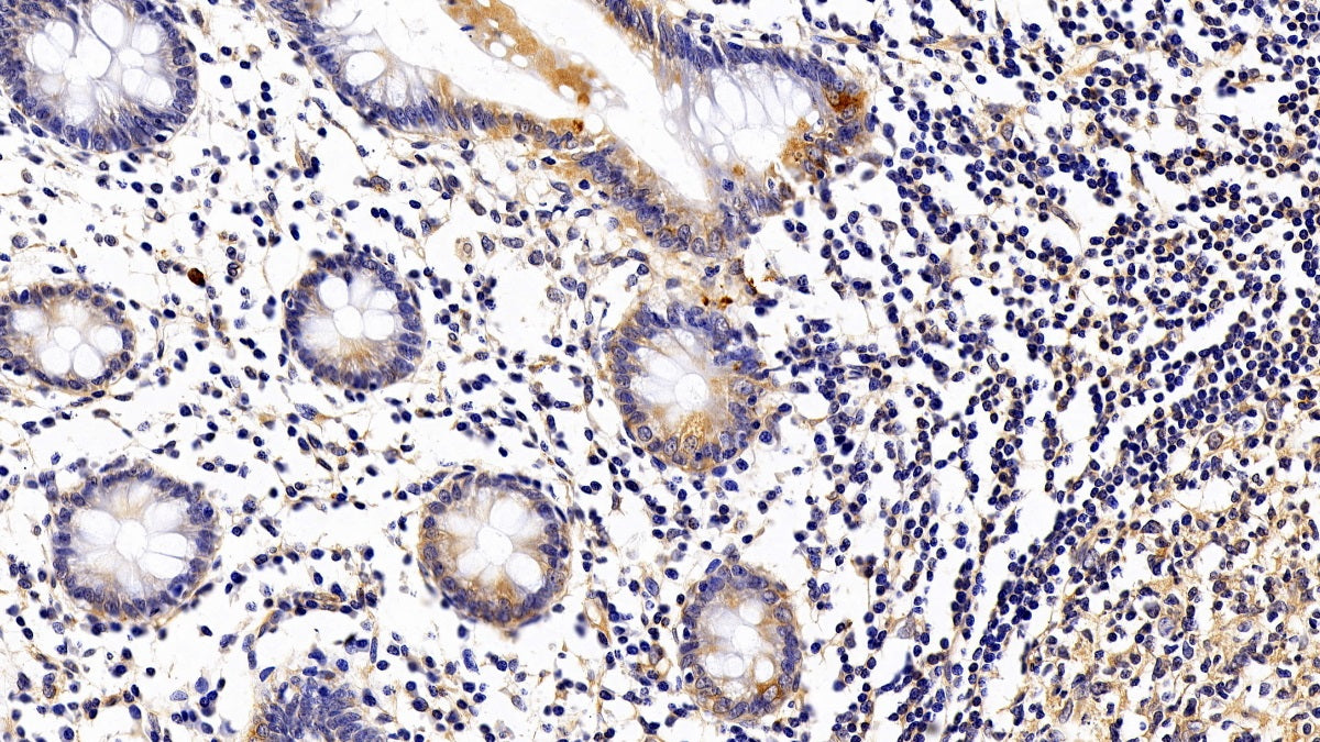 DABstainingonIHC-P.Samples:HumanTissue)