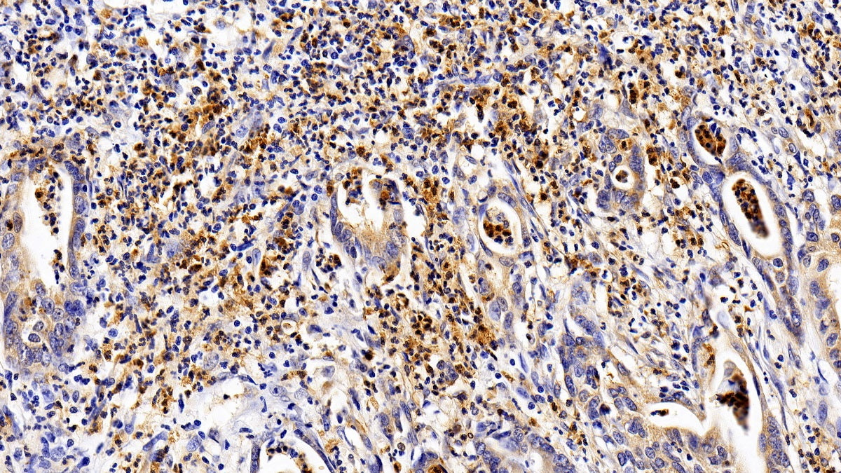 Interleukin 12 Receptor Beta 1 (IL12Rb1) Polyclonal Antibody - image 4