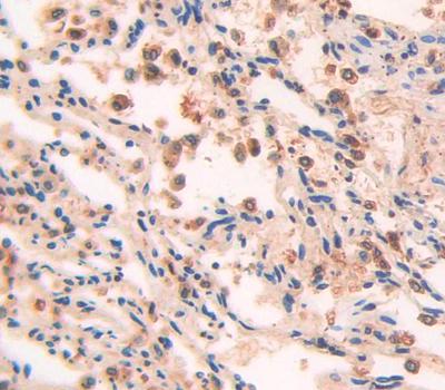 Transforming Growth Factor Beta Stimulated Protein Clone 22 (TSC22) Polyclonal Antibody - image 3