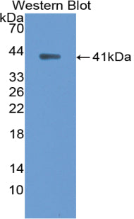 Ankyrin 1, Erythrocytic (ANK1) Polyclonal Antibody - image 2