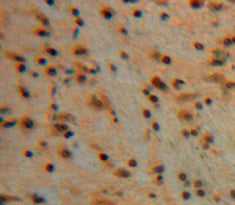 Ankyrin 1, Erythrocytic (ANK1) Polyclonal Antibody - image 3