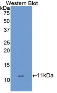 Dopamine Transporter (DAT) Polyclonal Antibody - image 2