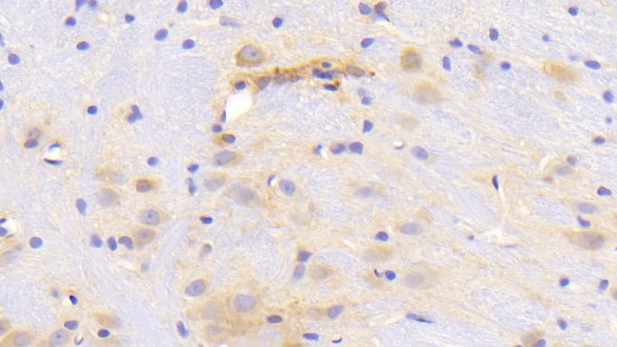 Dopamine Transporter (DAT) Polyclonal Antibody - image 3