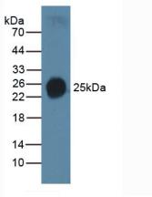 Western Blot; Sample: Recombinant SPC, Human.