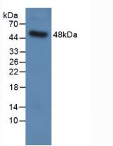 Used in DAB staining on fromalin fixed paraffin-embedded Lung tissue