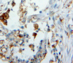 Surfactant Protein C (SP-C) Polyclonal Antibody - image 4