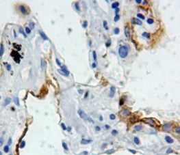 Surfactant Protein B (SP-B) Polyclonal Antibody - image 3