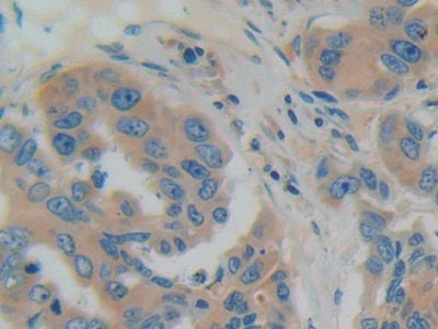 DAB staining on IHC-P; Samples: Human Liver Tissue.
