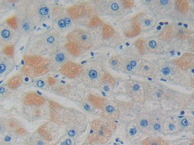 GDP Dissociation Inhibitor 1 (GDI1) Polyclonal Antibody - image 5