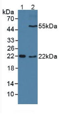 Western Blot; Sample: Recombinant CLEC4L, Human.