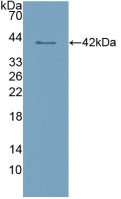 DAB staining on IHC-P; Samples: Human Kidney Tissue; Primary Ab: 10µg/ml Rabbit Anti-Human CLEC4L Antibody Second Ab: 2µg/mL HRP-Linked Caprine Anti-Rabbit IgG Polyclonal Antibody