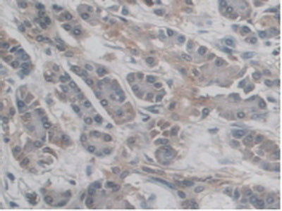 Cluster Of Differentiation 209 (CD209) Polyclonal Antibody - image 5