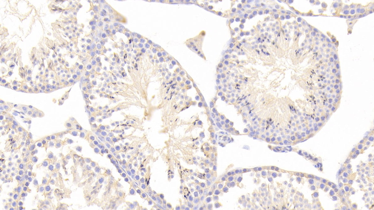 Thymosin Beta 4 (TMSB4X) Polyclonal Antibody - image 3