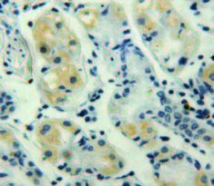 Chemokine (C-X-C Motif) Ligand 3 (CXCL3) Polyclonal Antibody - image 3
