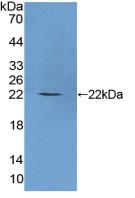 DAB staining on IHC-P; Samples: Human Cerebrum Tissue;  Primary Ab: 20µg/ml Rabbit Anti-Human PLCb1