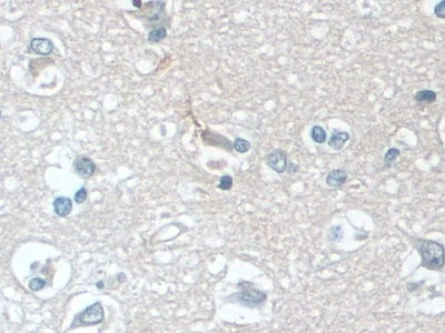 DAB staining on IHC-P; Samples: Human Stomach Tissue.