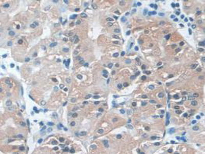 Phospholipase C Beta 1 (PLCB1) Polyclonal Antibody - image 5