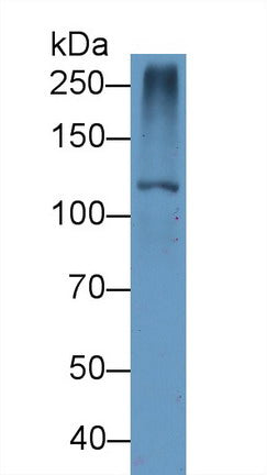Western Blot; Sample: Recombinant protein.