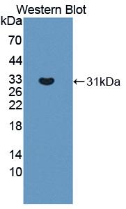 DAB staining on IHC-P; Samples: Mouse Testis Tissue; Primary Ab: 10µg/ml Rabbit Anti-Mouse Tyk2 Antibody Second Ab: 2µg/mL HRP-Linked Caprine Anti-Rabbit IgG Polyclonal Antibody