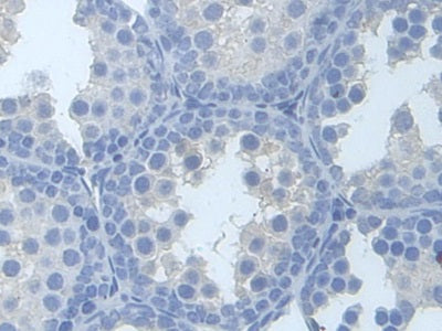 Tyrosine Kinase 2 (Tyk2) Polyclonal Antibody - image 4