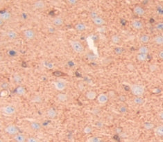 Cluster Of Differentiation 2 (CD2) Polyclonal Antibody - image 3