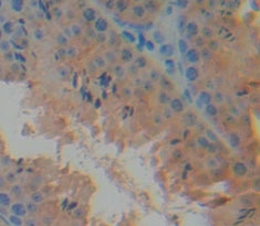 Mucosae Associated Epithelia Chemokine (MEC) Polyclonal Antibody - image 4