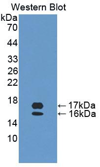 DAB staining on IHC-P; Samples: Human Colon Tissue;  Primary Ab: 20μg/ml Rabbit Anti-Human MEC Antibody Second Ab: 2µg/mL HRP-Linked Caprine Anti-Rabbit IgG Polyclonal Antibody