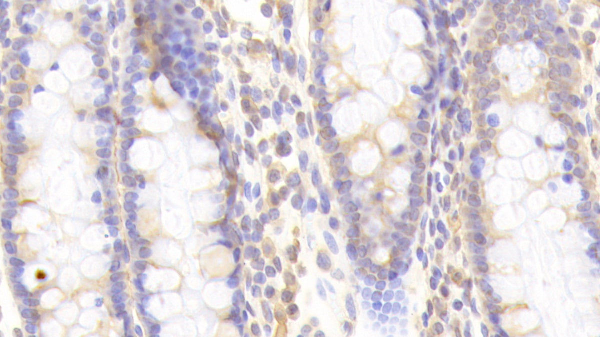 Mucosae Associated Epithelia Chemokine (MEC) Polyclonal Antibody - image 4