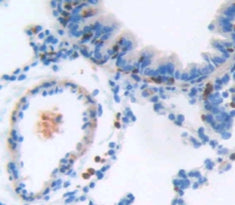 Intercellular Adhesion Molecule 4 (ICAM4) Polyclonal Antibody - image 3