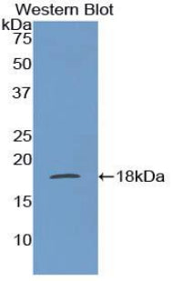 DAB staining on IHC-P; Samples: Mouse Liver Tissue; Primary Ab: 10µg/ml Rabbit Anti-Mouse FABP1 Antibody Second Ab: 2µg/mL HRP-Linked Caprine Anti-Rabbit IgG Polyclonal Antibody