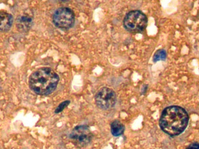 DAB staining on fromalin fixed paraffin-embedded Liver tissue)