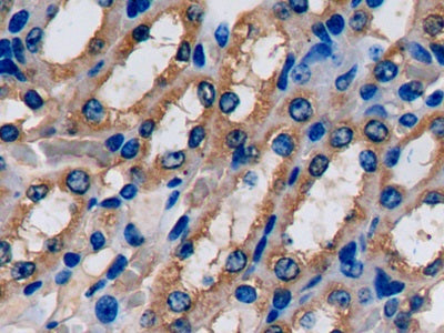 Fatty Acid Binding Protein 1 (FABP1) Polyclonal Antibody - image 5