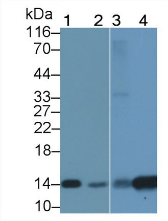 DAB staining on IHC-P; Samples: Human Liver Tissue;  Primary Ab: 20µg/ml Rabbit Anti-Human FABP1 Ant
