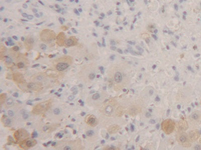 DAB staining on IHC-P; Samples: Human Liver Tissue