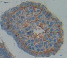 A Disintegrin And Metalloprotease 17 (ADAM17) Polyclonal Antibody - image 3