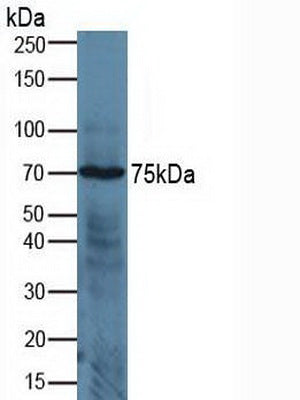 Western Blot; Sample: Recombinant ADAM17, Human.