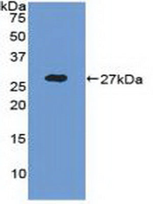 Used in DAB staining on fromalin fixed paraffin-embedded Kidney tissue