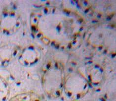 A Disintegrin And Metalloprotease 17 (ADAM17) Polyclonal Antibody - image 4