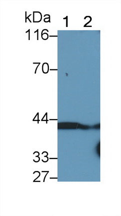 DAB staining on IHC-P; Samples: Human Kidney Tissue; Primary Ab: 10µg/ml Rabbit Anti-Human EMMPRIN Antibody Second Ab: 2µg/mL HRP-Linked Caprine Anti-Rabbit IgG Polyclonal Antibody