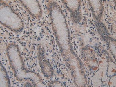 Cluster Of Differentiation 147 (CD147) Polyclonal Antibody - image 5