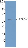 DAB staining on IHC-P; Samples: Human Liver Tissue; Primary Ab: 10µg/ml Rabbit Anti-Human CSE Antibody Second Ab: 2µg/mL HRP-Linked Caprine Anti-Rabbit IgG Polyclonal Antibody
